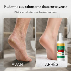 Spray rafraîchissant pour les pieds à base de plantes