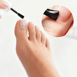 Solution antifongique pour les ongles