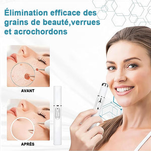 Stylo laser non invasif pour éliminer les acrochordons et les verrues