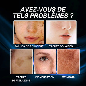 Crème blanchissante et anti-taches de rousseur à la vitamine C