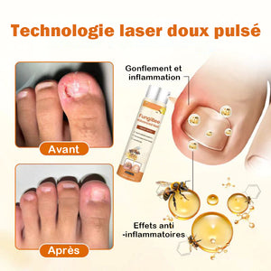 Spray réparateur d'ongles au venin d'abeille