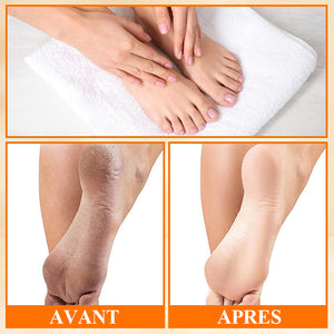 Spray exfoliant pour les pieds