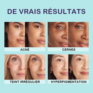 Crème tout-en-un – hydratant, anti-cernes et correcteur 💧✨ Légère et waterproof
