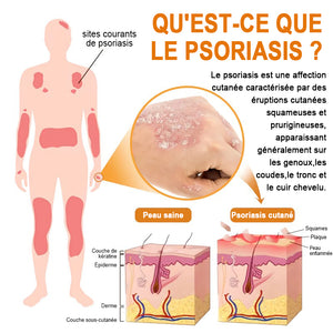 Spray contre le psoriasis au venin d'abeille