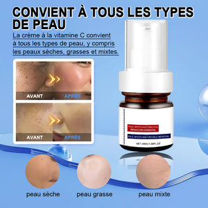 Crème blanchissante et anti-taches de rousseur à la vitamine C
