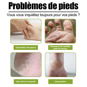 Spray exfoliant pour les pieds