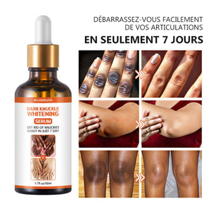 SÉRUM BLANCHISSANT POUR LES JOINTURES SOMBRES