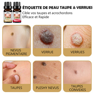 Ensemble de lotions puissante contre les verrues