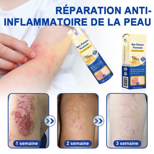 Spray contre le psoriasis au venin d'abeille