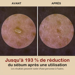 Ampoule exfoliante douce