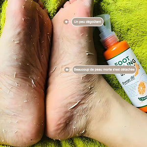 Spray exfoliant pour les pieds