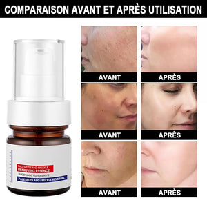 Crème blanchissante et anti-taches de rousseur à la vitamine C