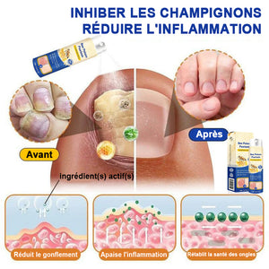 Spray contre le psoriasis au venin d'abeille