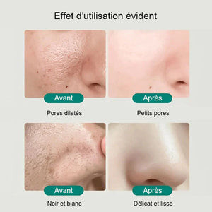 Nettoyant de niacinamide blanchissant pour le visage