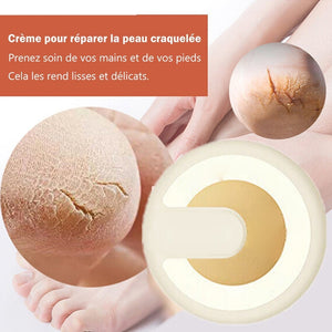 Crème anti-fissuration pour réparer la peau craquelé