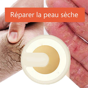 Crème anti-fissuration pour réparer la peau craquelé