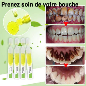 Sérum de blanchiment des dents éliminer les taches et blanchir les dents