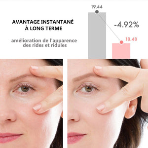 Bâton crème pour les yeux au rétinol