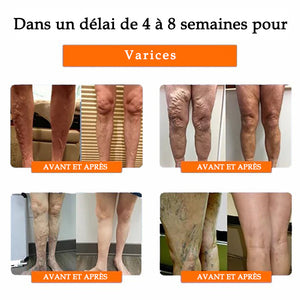 Genouillères thermiques à base de plantes radiofréquence (Recommandées par les experts - Convient à tous les problèmes de jambes)