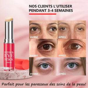 Bâton crème pour les yeux au rétinol