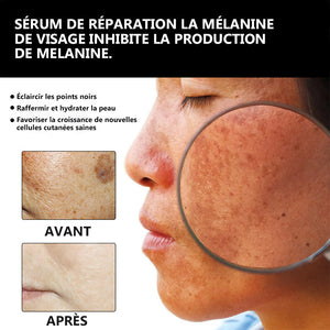 Sérum de réparation la mélanine de visage