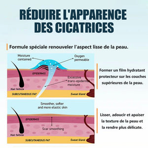 Gel pour l'élimination des cicatrices Atténuer les taches sombres