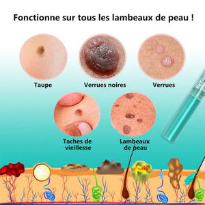 Sérum d'élimination d'étiquettes grains de beauté (3 pièces)