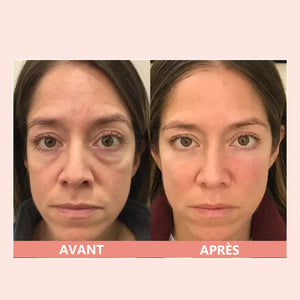 Crème réparatrice pour les yeux au peptide rétinol