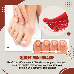 Chaussettes antifongiques pour les ongles