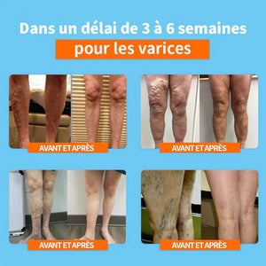 Bas longs en soie Correction Ionique et Détoxification Lymphatique